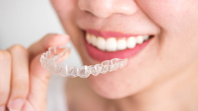 Alinhador transparente - mais estética no tratamento dentário