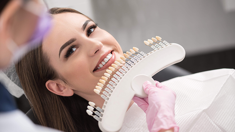 Clareamento dental: o que evitar após o procedimento? - Dental Arte