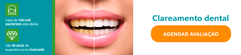 Clareamento Dental Antes e Depois, dentes amarelos x dentes brancos